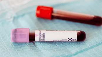 健康診断の血液検査で何がわかる？結果の見方と病気の前兆について